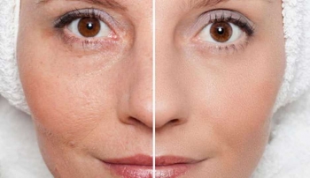 Cekmekoy Mimarsinan Dermapen Kursu Ozel Selen Akademi Guzellik Kursu