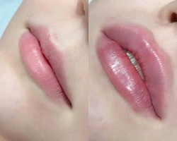 Botoks Kurslari Ve Fiyatlari Gercek Yorumlar Indirimler