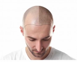 Sac Simulasyonu Kurslari Gercek Yorumlar En Iyi Fiyat Ve Iade Garantili Kurslar